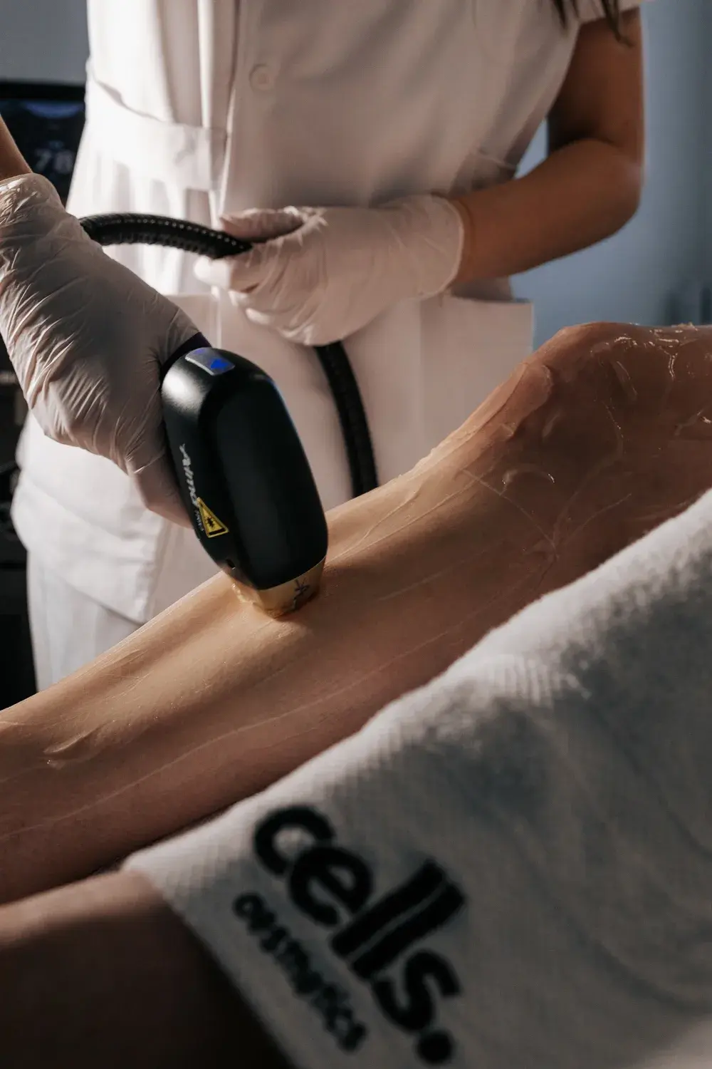 Soprano Titanium laser handpiece gliding over a gelled leg at Cells Aesthetics, Brighton & Hove